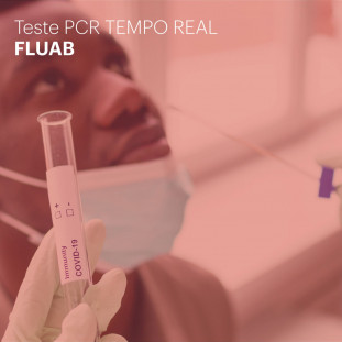 FLUAB INFLUENZA A/B PCR TEMPO REAL