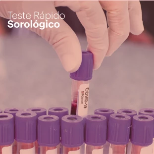 Teste Rápido Sorológico COVID-19 IgM/IgG