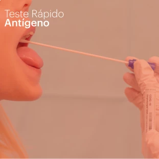 Teste Rápido Pesquisa Antígeno COVID-19