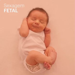 Sexagem Fetal